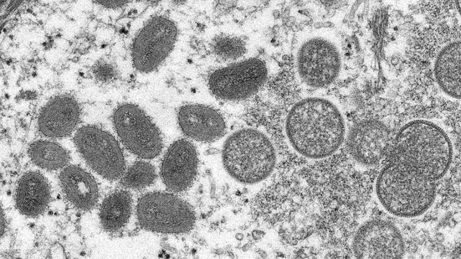 Monkeypox