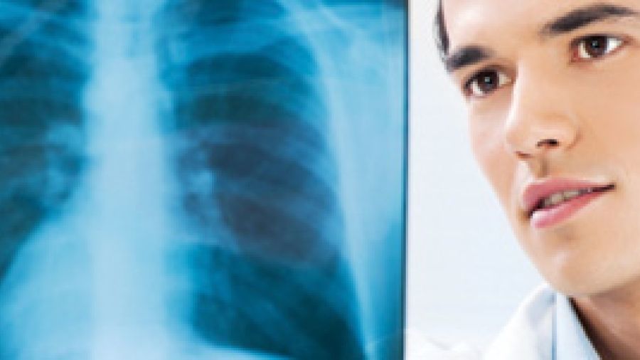 Tuberculosis